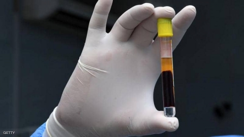 مصابو كورونا ليسوا كما أعلنت أميركا