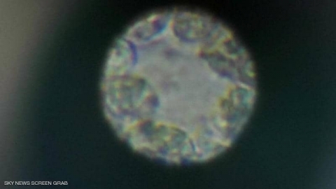 منظمة الصحة العالمية تكشف حقيقة 