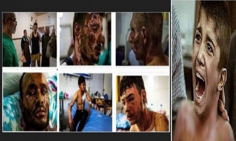 مطالبة بريطانية بتحقيق 