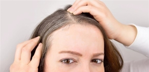 الشيب المبكر قد ينذر بمشكلة صحية... هذا ما يجب أن تعرفيه!