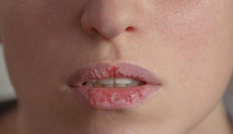 أسباب جفاف الفم في رمضان ونصائح للتخلص منه