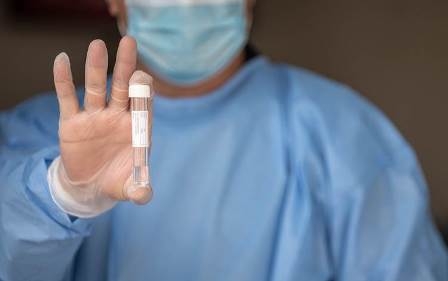 اليابان تمنح العراق مساعدة مالية لمواجهة فيروس كورونا