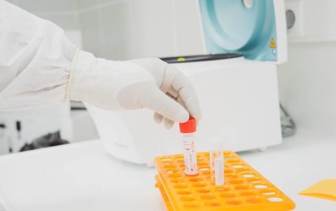 12 إصابة جديدة بفيروس كورونا في إقليم كوردستان