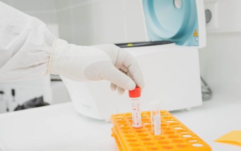 الصحة العالمية تعلق على اعتماد العراق العقار الروسي لفيروس كورونا