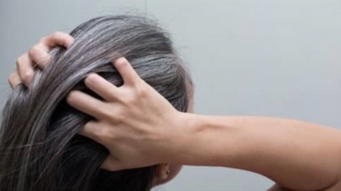 هل ظهور الشعر الأبيض مرتبط بالتوتر؟ إليكم الاجابة!