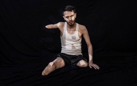 صور 3 بيشمركة من جرحى الحرب ضد داعش تحصد الجائزة الذهبية لمهرجان في كوريا الجنوبية