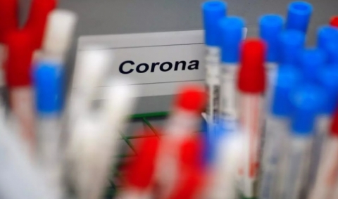 طبيب روسي يكشف أبسط طريقة للتعرف على الإصابة بكورونا