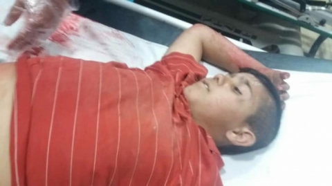 قتلى وجرحى من المدنيين على يد ميليشيات المعارضة في عفرين