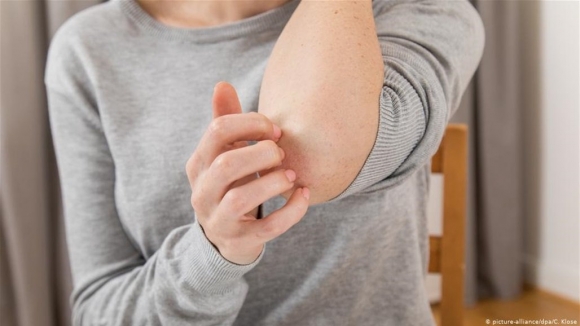 التغيرات الجلدية تنذر بأمراض خطيرة... إياكم تجاهلها!