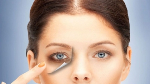 ظهور الهالات السوداء حول العينين يؤشر بأمراض خطيرة... احذروها!