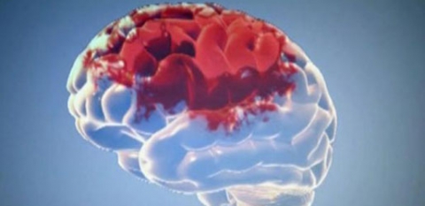 عدم تناول الافطار صباحا يسبب الجلطة الدماغية