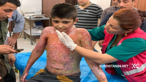 بتوجيه من الرئيس  البارزاني.. الطفل محمد ينقل الى فرنسا للعلاج