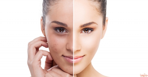 تصفية وتنقية البشرة والتخلص من الهالات السوداء