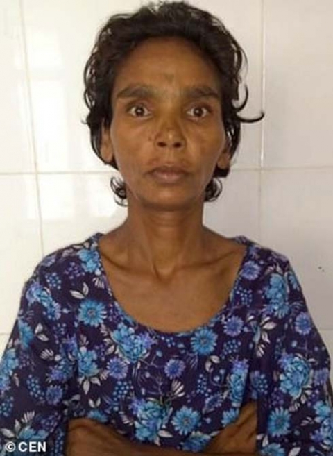 أطباء يصابون بصدمة بسبب ما وجدوه في بطن سيدة