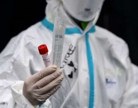 الكشف عن أول جرعة تجريبية للقاح كورونا