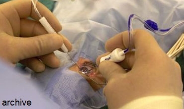 إيطالي ينتزع عينيه لعدم النظر إلى زوجات الآخرين