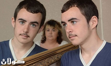 منعه الطبيب من الحلاقة.. ففصل من المدرسة بسبب شاربيه!!