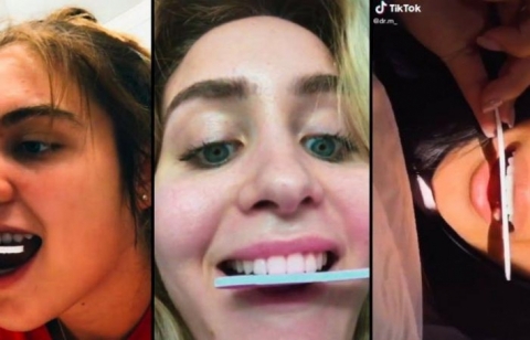 تحد للأسنان ينتشر على 