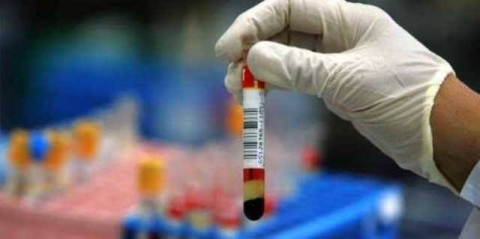 تقرير يحذر الرجال من 