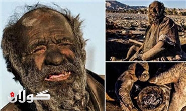 ظهور فيديو عن الإيراني الذي لم يستحم منذ 60 سنة