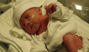 ولادة طفل عراقى دون لسان وبفتحة فى الظهر.(سبحان الله )..