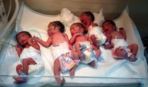 سيدة كوردية تلد 5 توائم بمدينة القامشلي بكوردستان سوريا