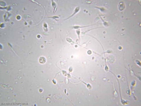 الصين تبتكر وسيلة خاصة بالرجال لمنع الحمل