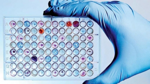 فحص رخيص للأمراض الخطيرة في أقلّ من ساعة