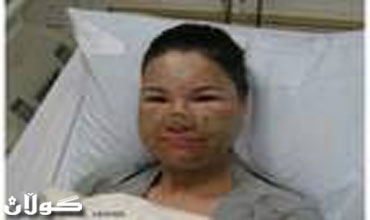 ظاهرة انتحار النساء في كردستان العراق