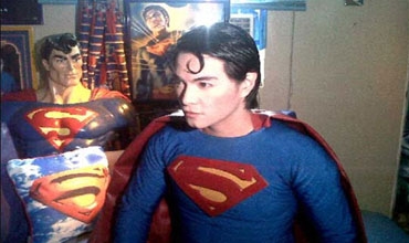 خضع لسلسلة عمليات جراحية ليصبح شبيه 