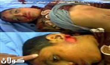 28 قتيلا بينهم أطفال وإضراب عام في سوريا