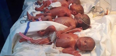 عراقية عشرينية تنجب 7 توائم 