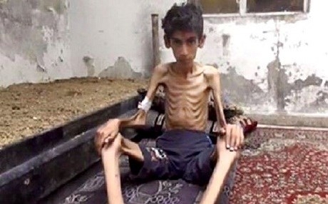 Xwarin gihîşt destê wan - Ji birçîna dimirin!