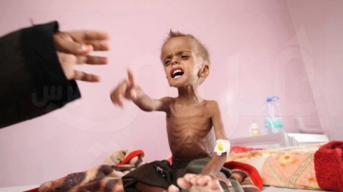 Di nava 4 salan de 85 hezar zarok canê xwe ji dest dane