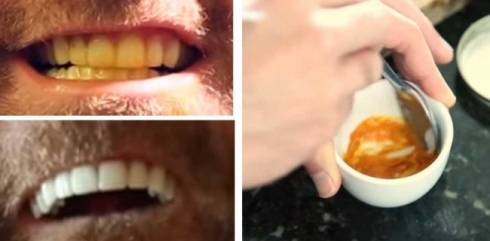 Tenê bi 3 amûrên malê ji diranên zerbuyî rizgar bibin