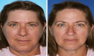 Cixarekêş zûtir pîr dibin