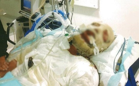 Dayika 10 zarokan xwe şewitand