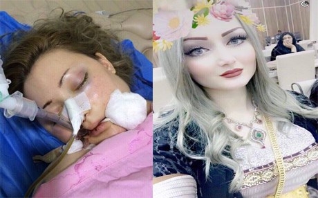 Piştî 6 mehan gora Dilînê dê were vekirin