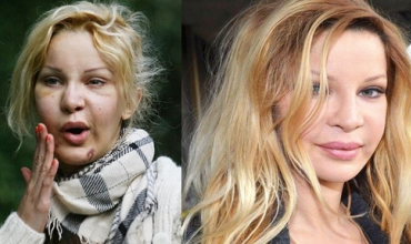 331 caran estetîk kiriye