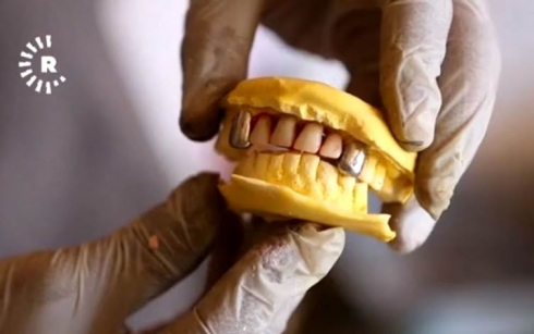 Di çadira xwe ya biçûk de diranên zêr û zîv çê dike