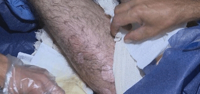  Peshmerga: ISIS may have used chemical weapons in Makhmur 