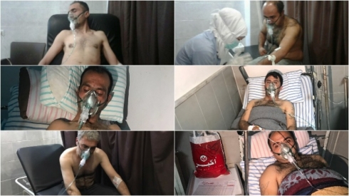 YPG: Artêşa Tirkiyê çekên kîmyayî li Efrînê bikar anî!