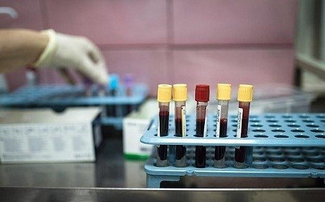 Her sal ji ber nexweşiyan bi milyonan mirov dimirin