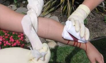 Li Duhokê di meha borî da 32 gencan rehên destên xwe birîne