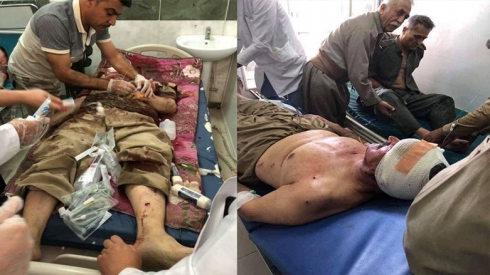 Sekreterê Giştî yê HDK birîndar bû