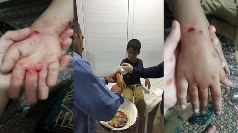 Li Herêma Kurdistanê zarokek ji devê gurekî hat rizgarkirin