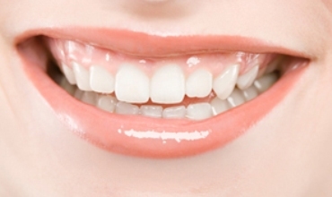 Ji bo ku qelew nebin diranên xwe girêdidin