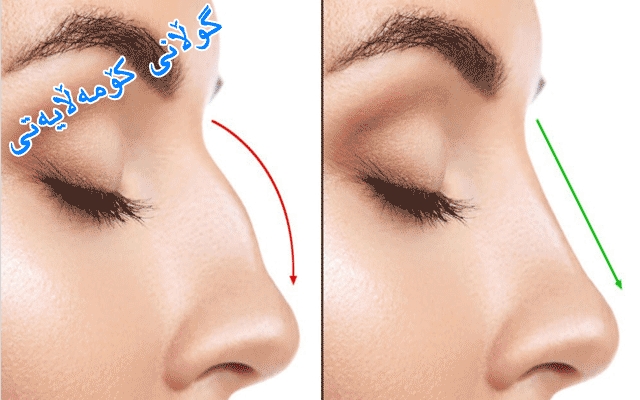 خواستی خانمان لەسەر  نەشتەرگەریی جوانكاری پەرە دەستێنێ