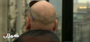 Male baldness 'indicates heart risk'