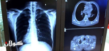 Saudi Arabia Reports 7 Cases of SARS-Like Virus